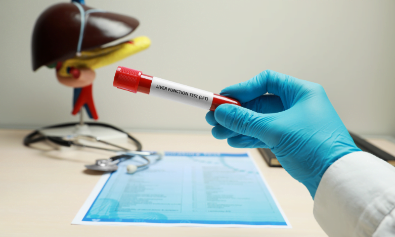 Liver-cancer Liver cancer