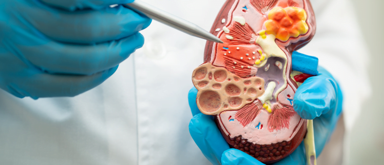 Nephrology Treatment in India