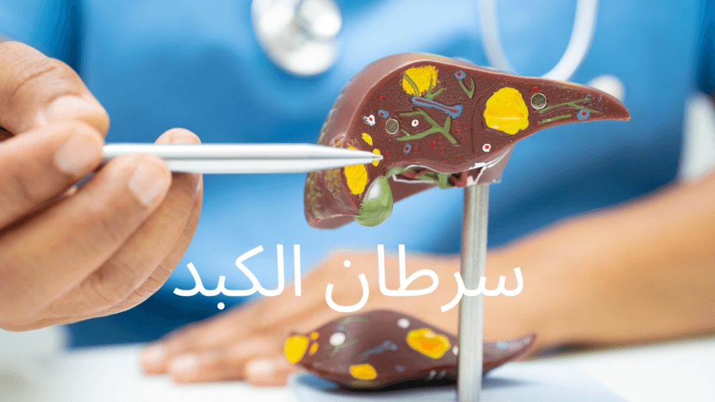 سرطان الكبد