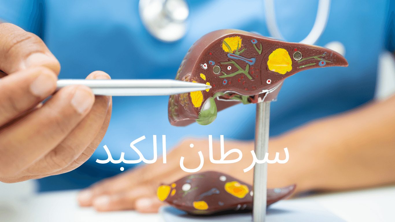 سرطان الكبد