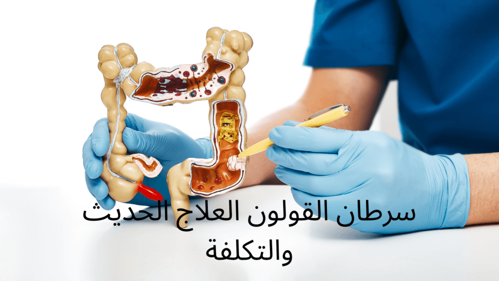 سرطان القولون