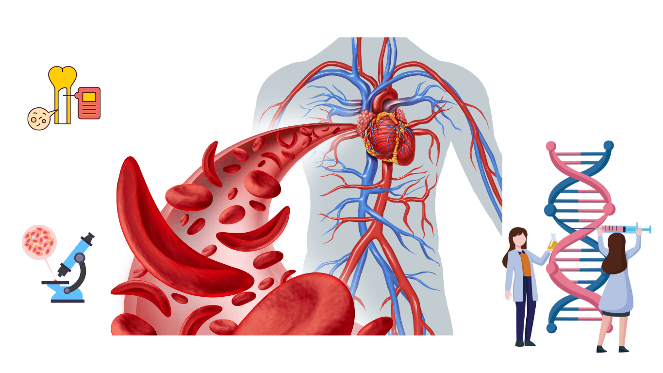 انيميا منجلية