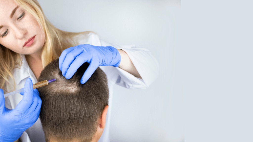 مرض الثعلبة