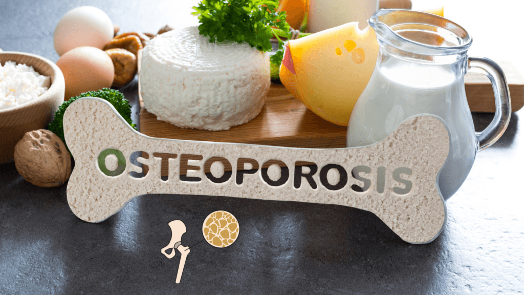 هشاشة العظام