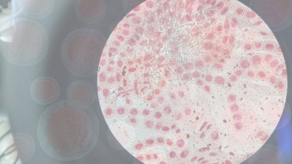 افضل تكلفة لعملية زراعة نخاع العظم في الهند