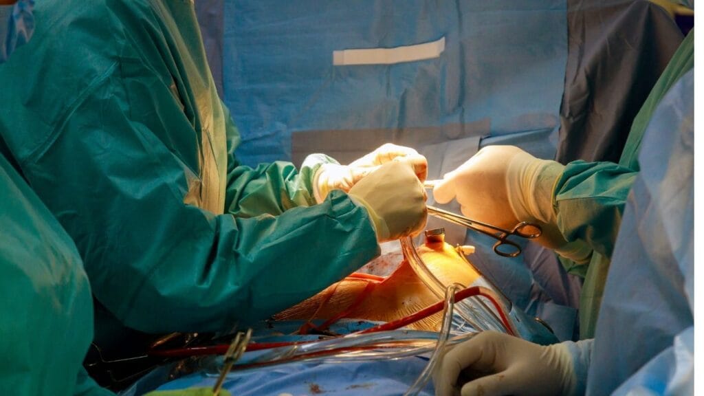 تكلفة زراعة صمام القلب الاورطي بالقسطرة في الهند