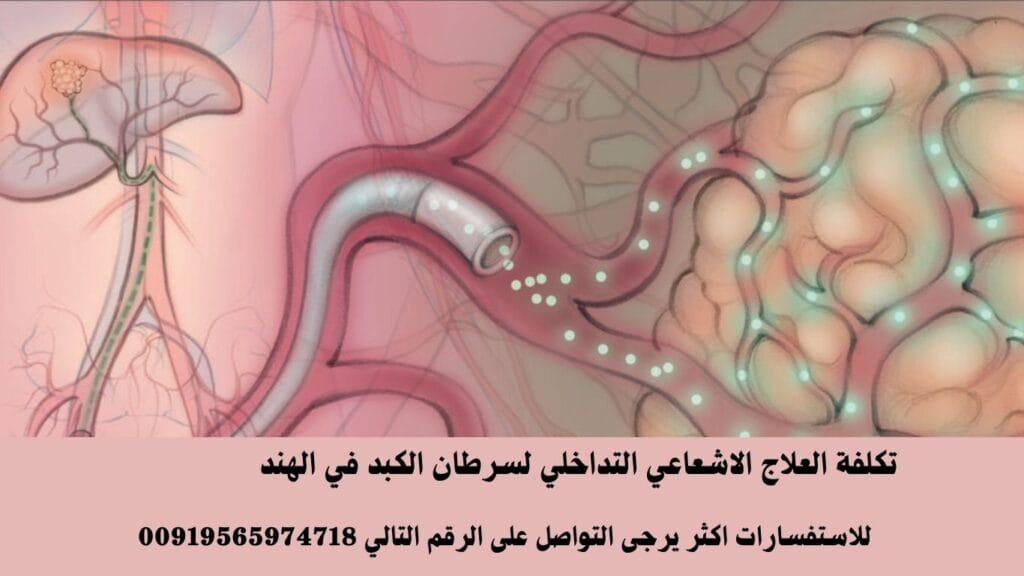 تكلفة العلاج الاشعاعي التداخلي لسرطان الكبد في الهند